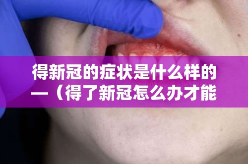 得新冠的症状是什么样的—（得了新冠怎么办才能好得快）